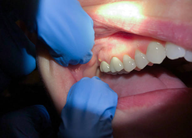 Best Broken or Chipped Tooth Repair in Genoa, IL